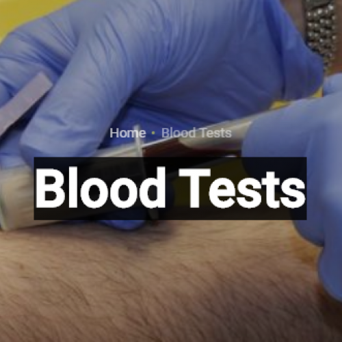 Blood Tests